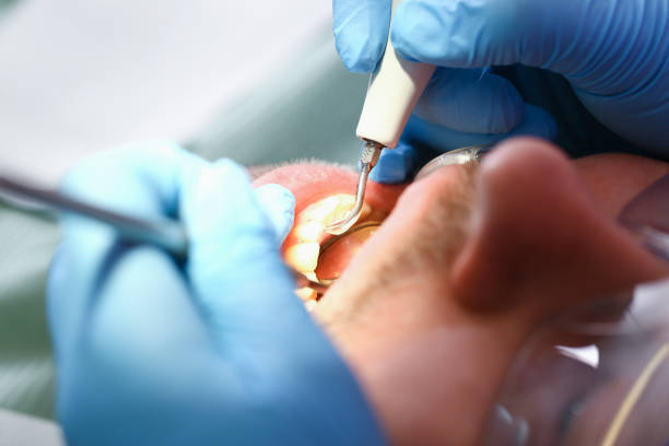 Best Weekend Emergency Dentist in Tucker, GA