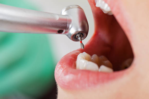 Best Urgent Dental Care for Toothache in Tucker, GA